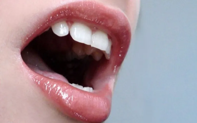 Καρκίνος στόματος: Τα 12 σημάδια που δεν πρέπει να αμελείτε