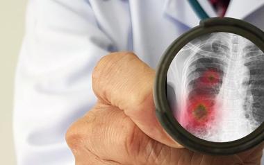 Αν τραβάτε το καζανάκι με ανοιχτό καπάκι - υπάρχει αυξημένος κίνδυνος εξάπλωσης του κορωνοϊού