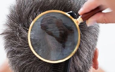 Γιατί τελικά ασπρίζουν τα μαλλιά μας; 