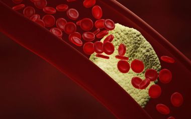 Πρόβλημα στην κυκλοφορία του αίματος: Τα σημάδια που δεν πρέπει να αγνοήσετε 