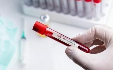 Ομάδα αίματος και κορονοϊός- Κινδυνεύουν περισσότερο όσοι έχουν αυτή την ομάδα αίματος;