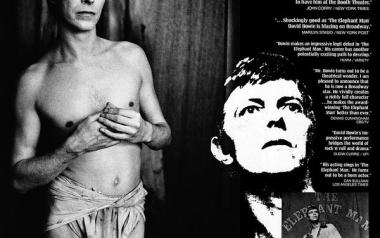 1981 o David Bowie στο Elephant Man