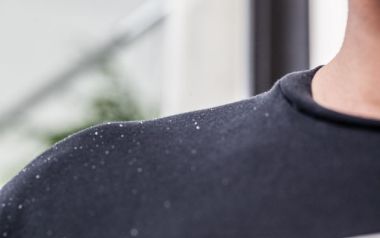 Πιτυρίδα: Πώς υποχωρεί με φυσικά υλικά που έχετε στο σπίτι