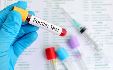Φερριτίνη: Τι δείχνει, ποιες είναι οι φυσιολογικές τιμές