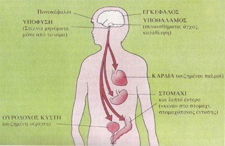 Ψυχοσωματικά: Σε ποια σημεία του σώματος μπορεί να σε χτυπήσει το άγχος 